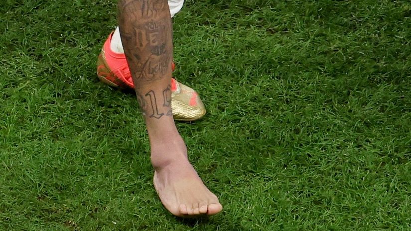 Izgled Nejmarovog stopala posle utakmice (©Reuters)
